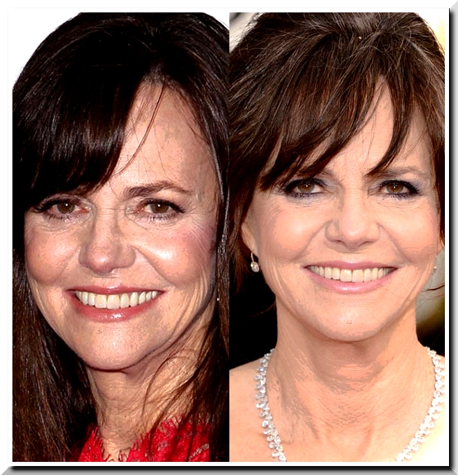 Sally fields pictures
